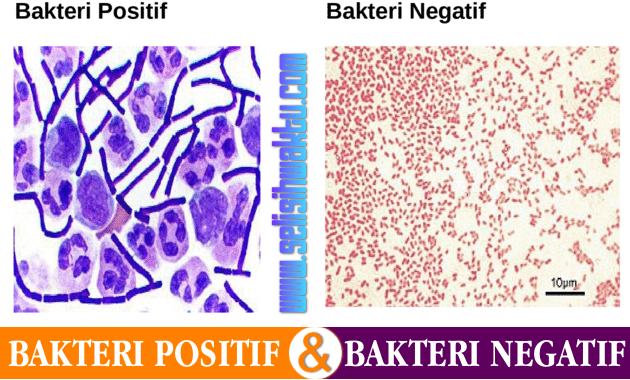 GRAM POSITIF DAN NEGATIF PADA BAKTERI GRAM POSITIF DAN NEGATIF PADA BAKTERI